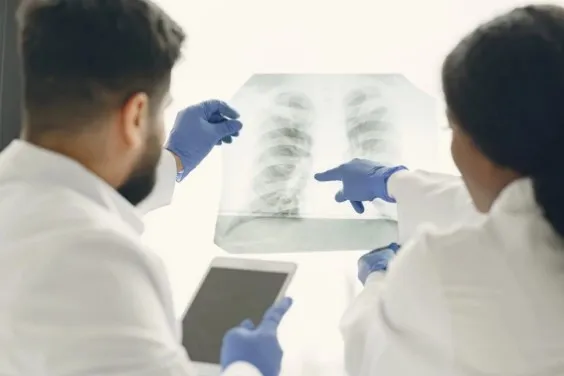 10 Fakta Penting Seputar TBC (Tuberkulosis) yang Perlu Kamu Tahu