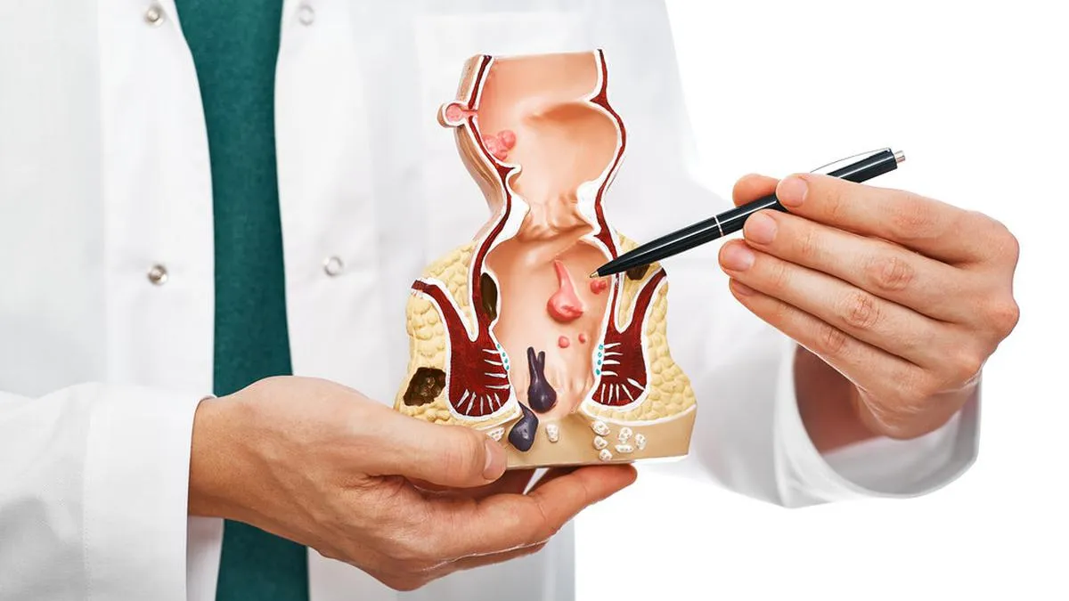 Ambeien Ke Dokter Apa? Panduan Lengkap untuk Penanganan Terbaik
