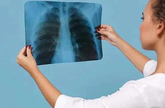 Apa Itu Fibrosis Paru dan Bagaimana Cara Penanganannya?