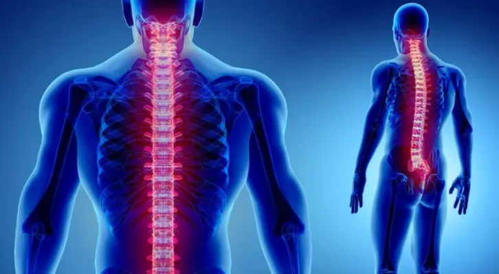Apa Itu Osteoporosis? Memahami Kerapuhan Tulang yang Disebabkan oleh Penurunan Kepadatan Massa