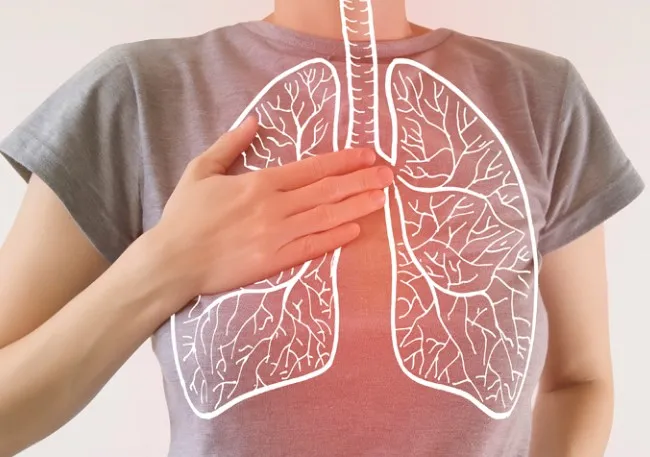 Apa Itu Pneumonia? Ketahui Gejala dan Pengobatannya