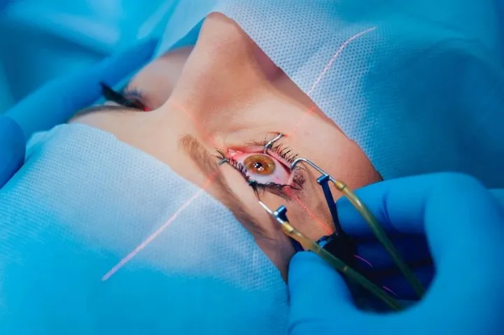 Apakah Semua Jenis Mata Minus Bisa Dioperasi LASIK?