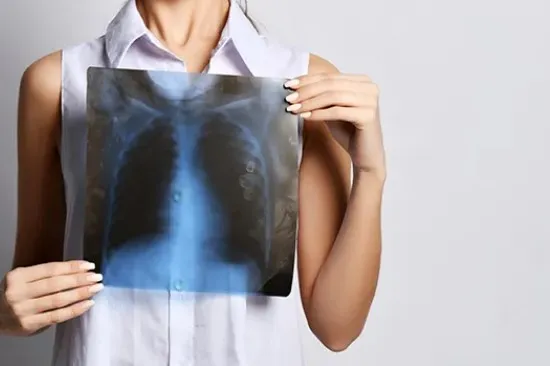 Bahaya Penyakit Bronkitis Kronis dan Cara Pencegahannya