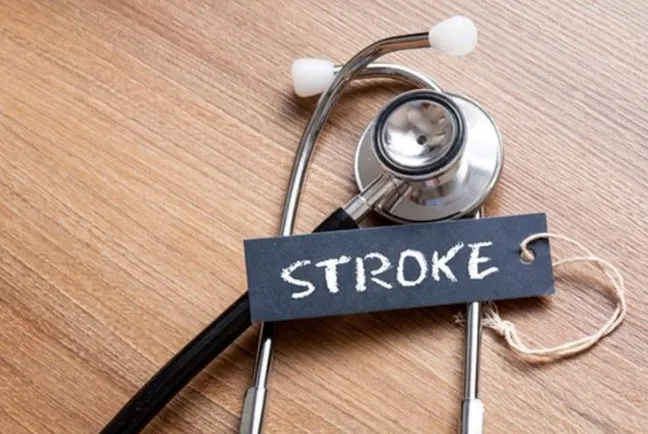 Faktor Risiko Stroke yang Sering Diabaikan