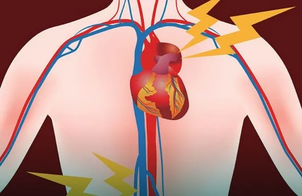 Hal yang Wajib Diwaspadai dari Aneurisma Aorta