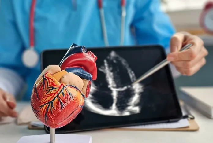 Hasil Angiogram Menunjukkan Penyempitan, Apa Langkah Selanjutnya?