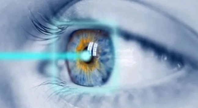 Ini Beberapa Perawatan Pasca Lasik yang Perlu Diketahui