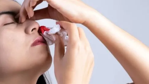 Kenali Gejala, Penyebab, dan Solusi Terbaik Pengobatan Kanker Hidung