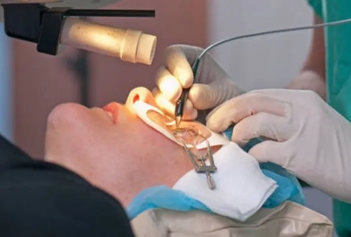 Lasik vs Operasi Katarak, Mana yang Cocok untuk Anda?