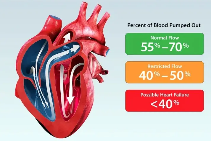 Memahami Perbedaan Heart Failure dengan Ejection Fraction Rendah vs Tinggi