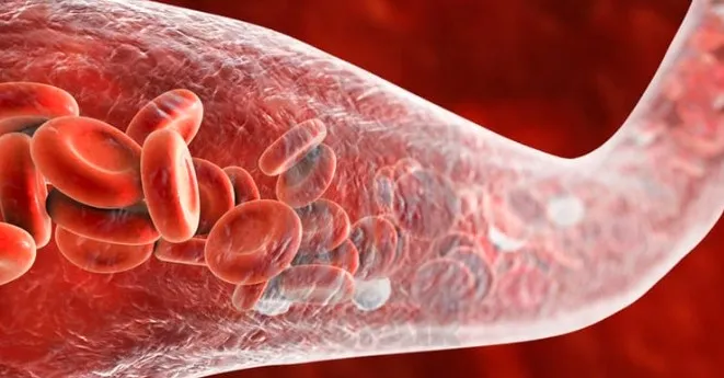 Mengenal Angiosarcoma Kanker Pembuluh Darah yang Perlu Kita Waspadai