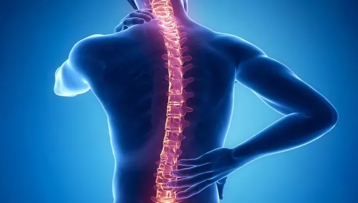 Mengenal Skoliosis, Jenis Kelainan pada Tulang yang Perlu Diwaspadai Sejak Dini