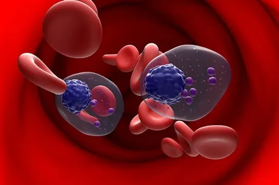Modern Cancer Hospital Guangzhou Jadi Solusi Pengobatan Lanjut Multiple Myeloma