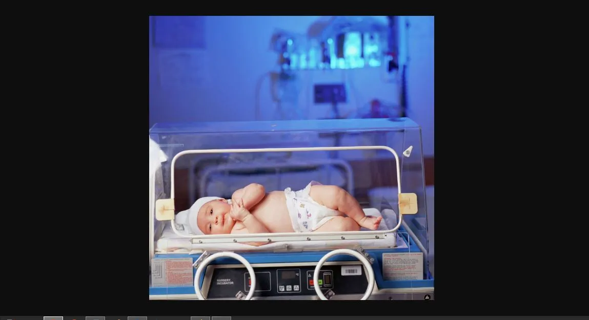 Neonatologi Adalah: Mengupas Tuntas Dunia Perawatan Bayi Baru Lahir