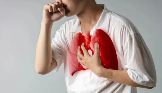 Pengaruh Infeksi Virus terhadap Kesehatan Paru Paru Jangka Panjang