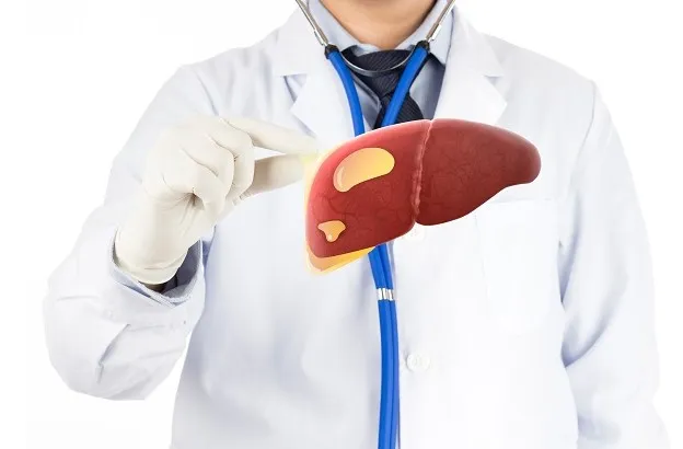 Penyebab Umum Fatty Liver (Perlemakan Hati)