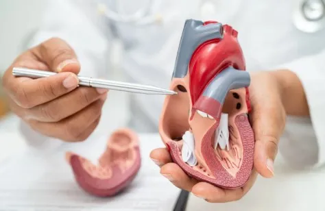 Penyumbatan Jantung 70% Apakah Harus Pasang Stent?
