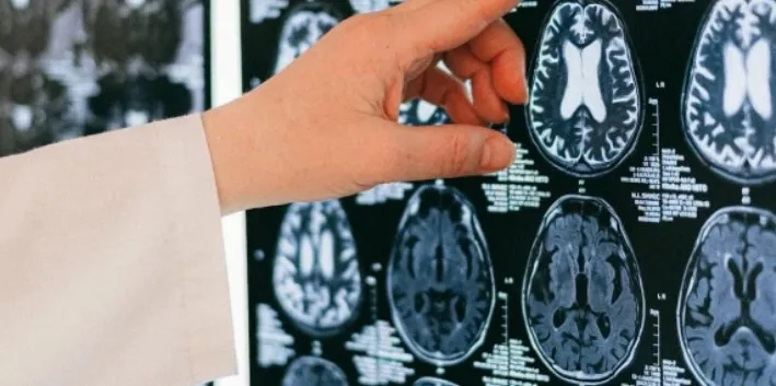 Peran Teknologi dalam Deteksi Dini Kanker