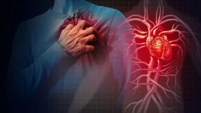 Perbedaan Serangan Jantung dan Angina Kenali Gejalanya Sejak Dini