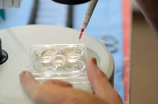 Prosedur, Biaya, dan Peluang Keberhasilan Program Bayi Tabung (IVF) di Malaysia