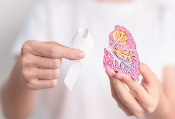 Risiko Kanker Paru Paru Setelah Sembuh dari TBC