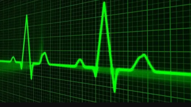 Ritme Jantung Tidak Normal di Usia Muda, Apakah Perlu Rujuk ke Dokter Spesialis?