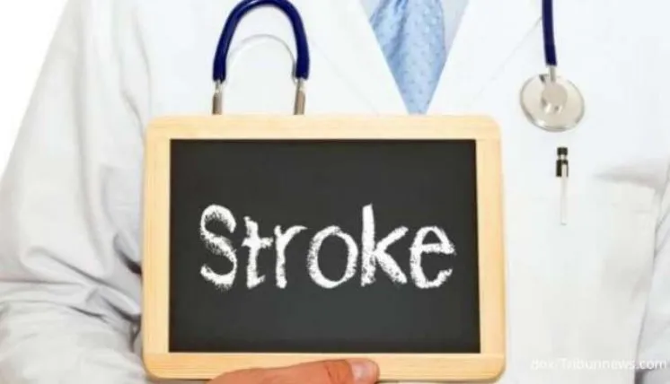 Tanda-Tanda Stroke Ringan yang Sering Diabaikan