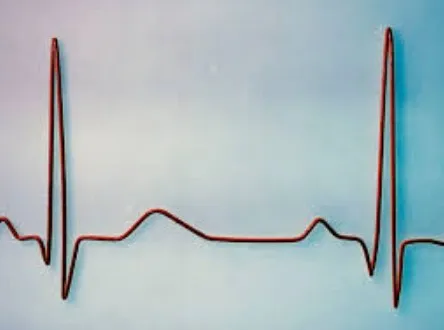 Tes dan Pemeriksaan yang Digunakan untuk Mendiagnosis CAD (Coronary Artery Disease)