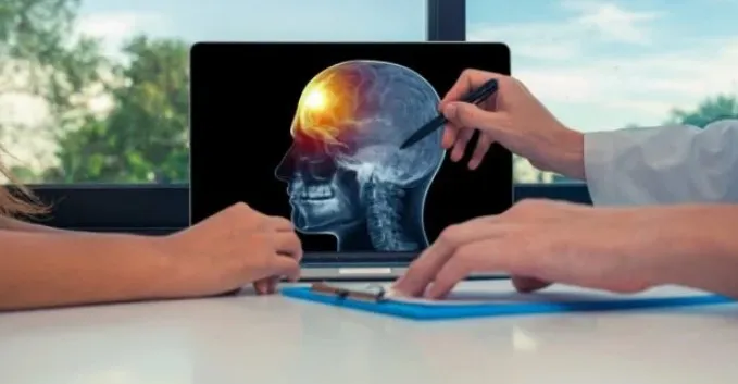 Tumor Otak Apakah Bisa Sembuh? Simak Metode Pengobatan Terbaiknya